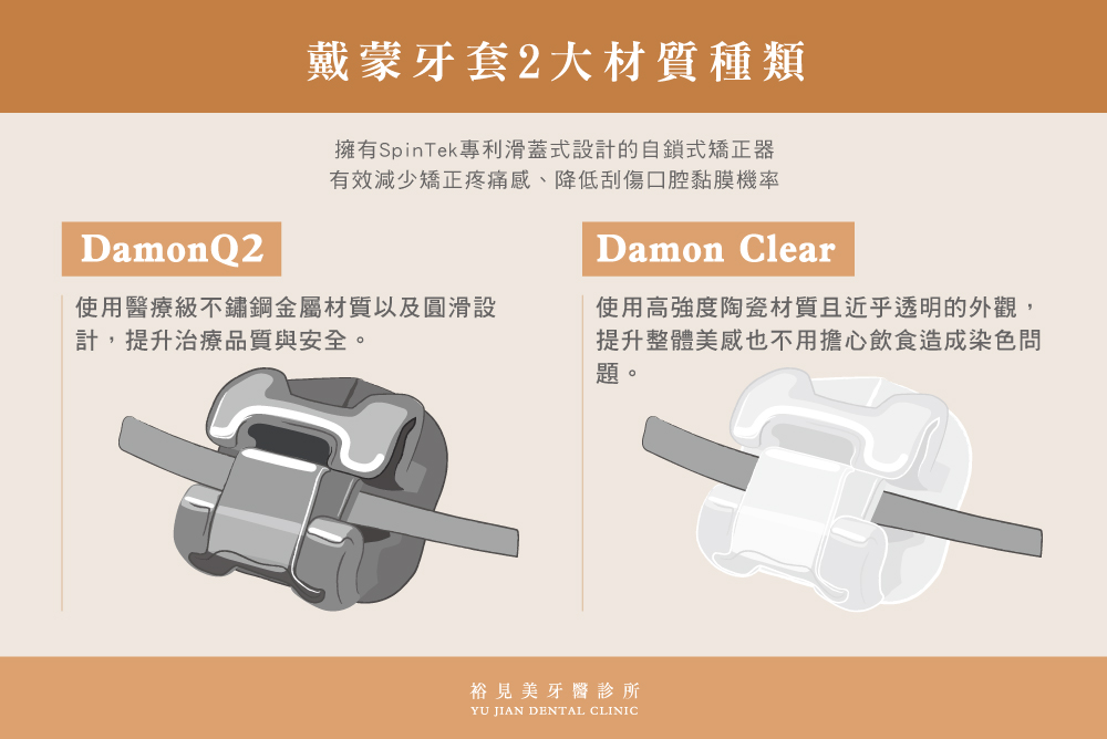 戴蒙牙套2大矯正材質:金屬DamonQ2、陶瓷Damon Clear